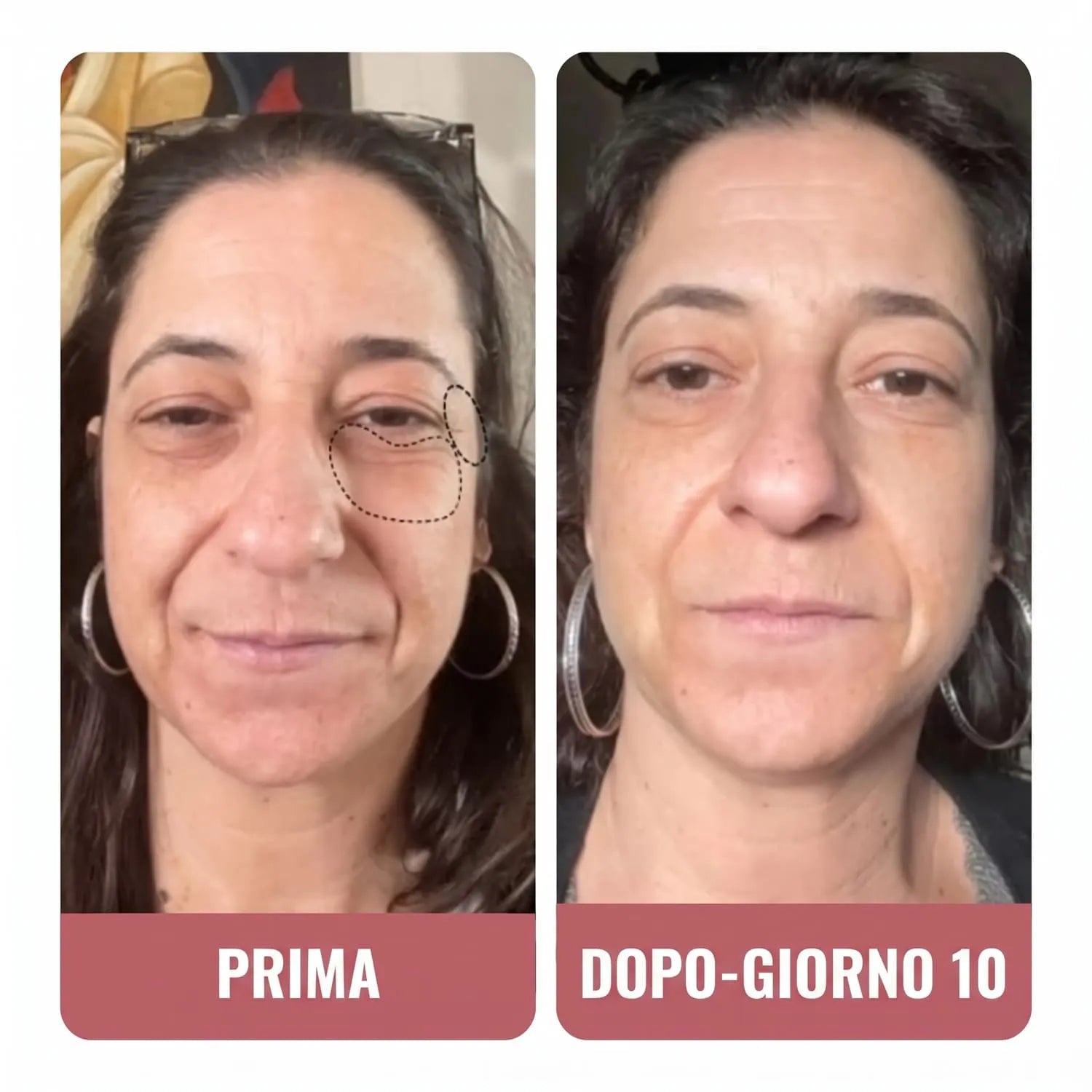 Il mio contorno occhi è più levigato e meno scuro.