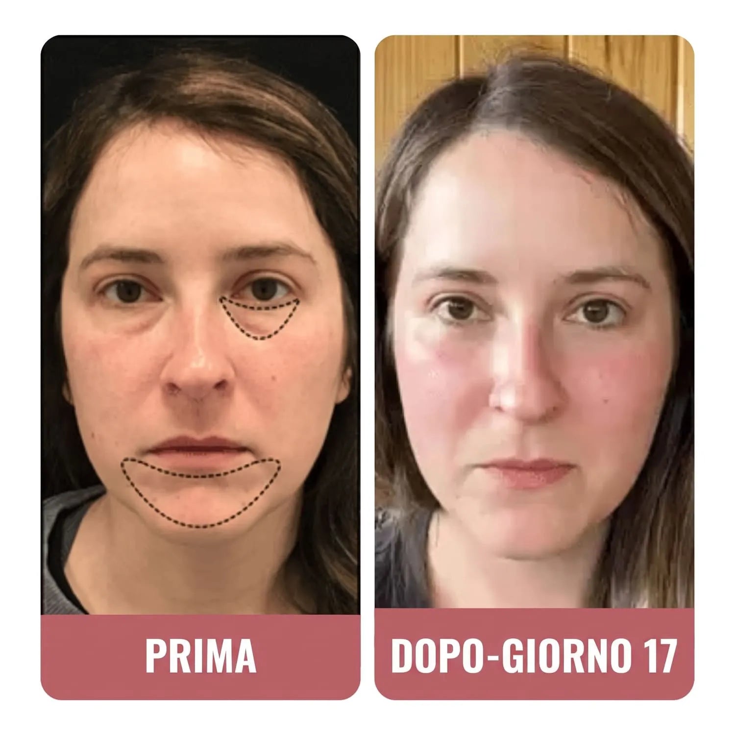 Questa crema ha trasformato il mio sguardo.