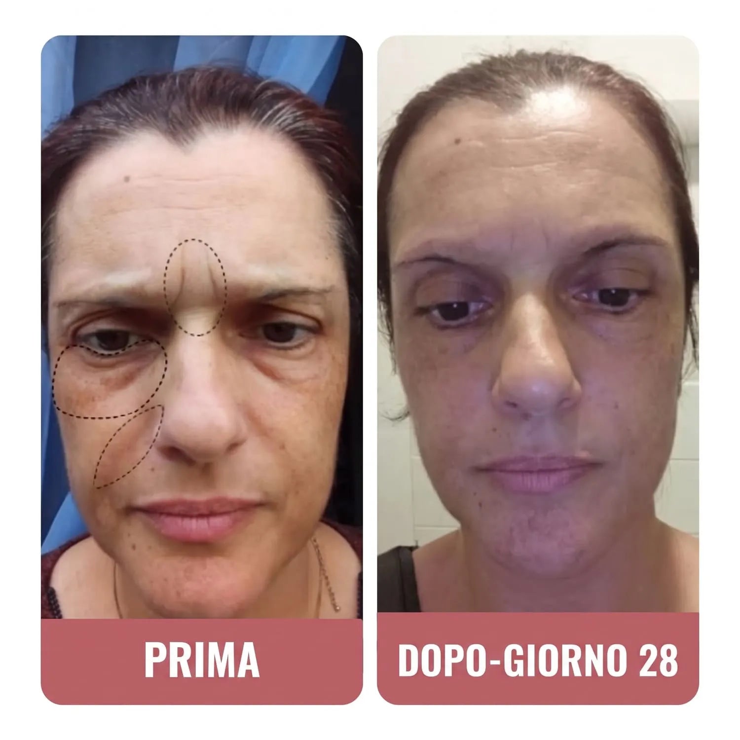 Questa crema Wombea è impressionante.