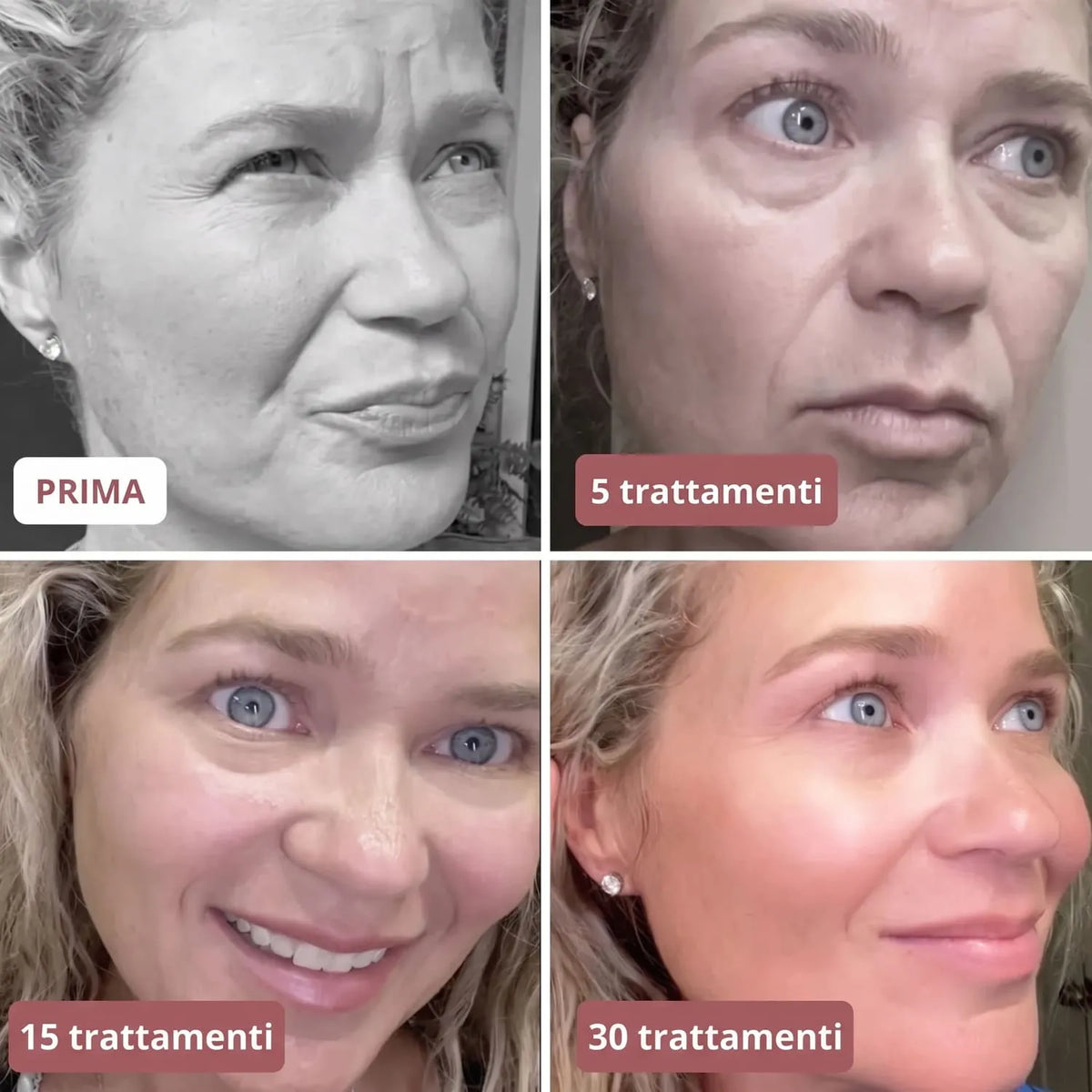 5 Mascheres al collagene