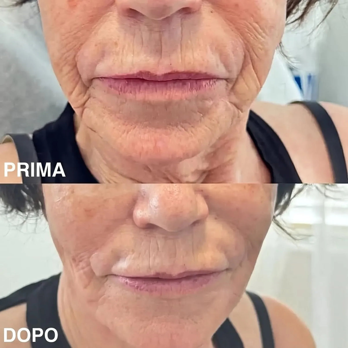 Balsamo Rimpolpante al Bio-Collagene con PDRN