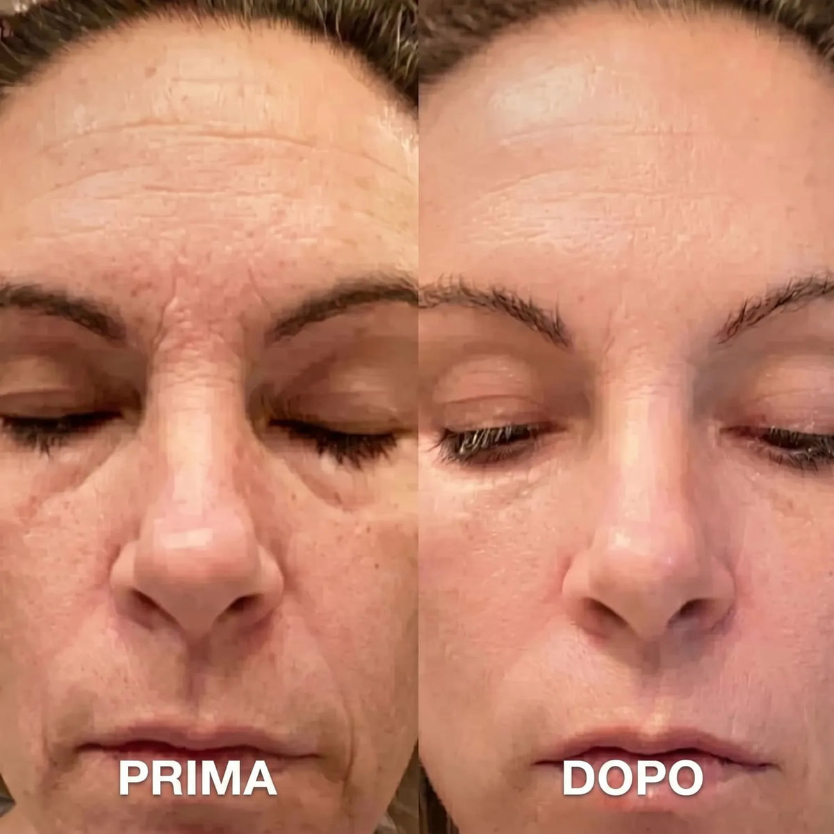 Balsamo Rimpolpante al Bio-Collagene con PDRN