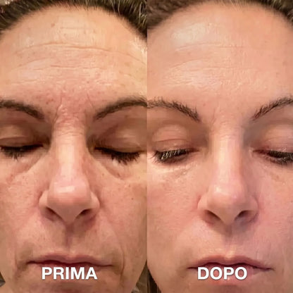 Balsamo Rimpolpante al Bio-Collagene con PDRN