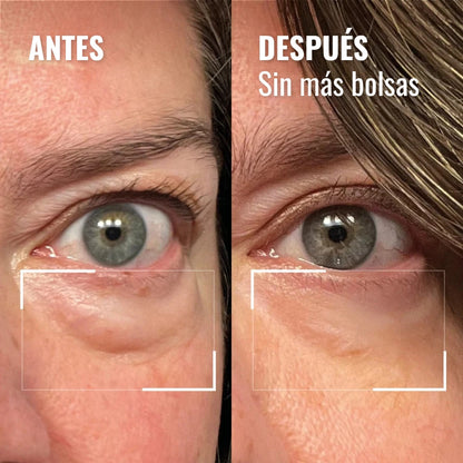Crema a luce rossa per il contorno occhi